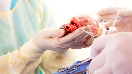 https-inteng-storage-s3-amazonaws-com-img-iea-ne6n17xqg5-sizes-heart-surgery-transmedics-main_md-jpg