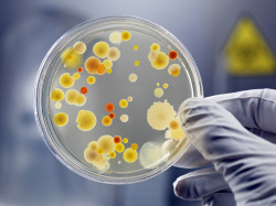 https-www-sepsis-org-images-upload-bacteria_petri_dish_smaller-jpg