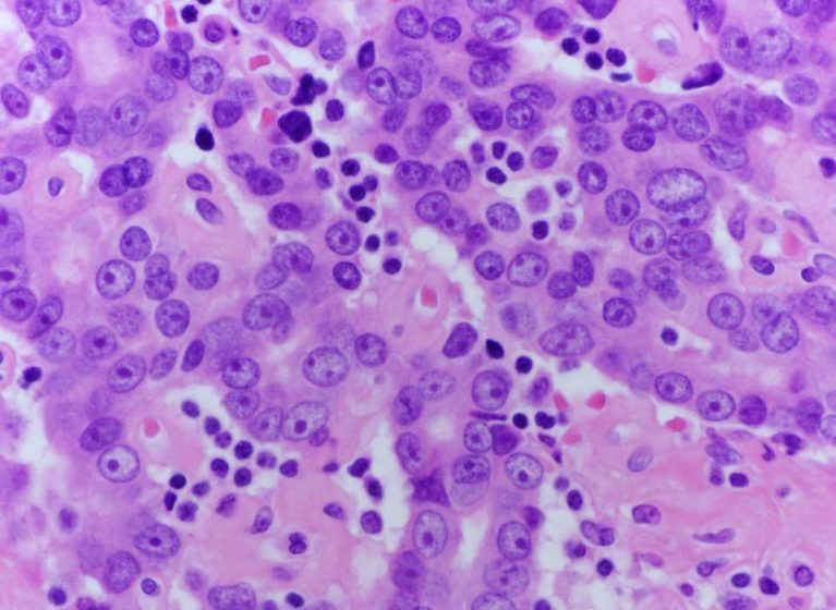 How Androgen Controls the Conversation in Prostate Cancer Cells