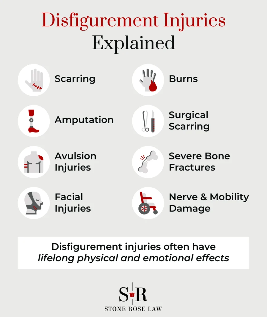 What Is a Disfigurement Injury_